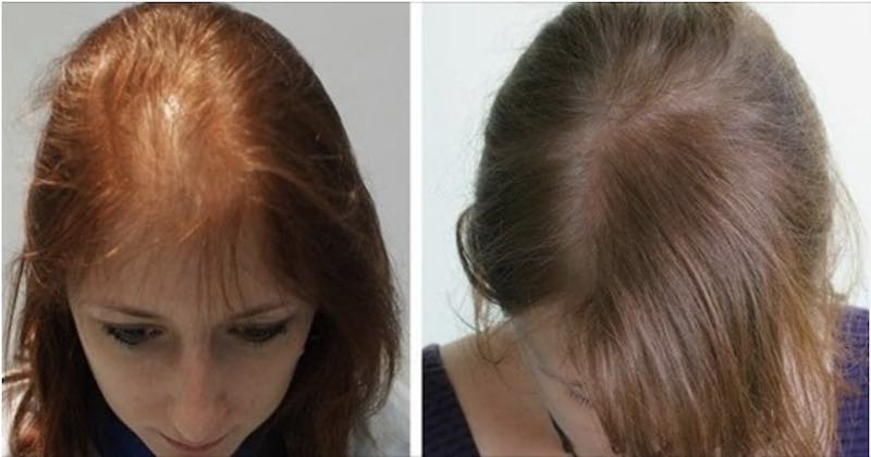 prima e dopo olio di ricino capelli