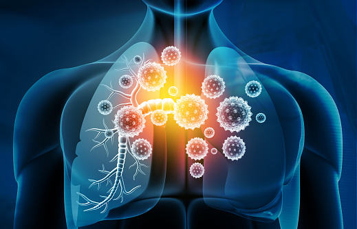 infezioni ai polmoni dolore altezza polmoni dietro al ventre