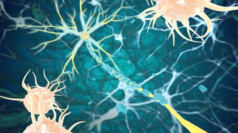 problemi neurologici omocisteina alta