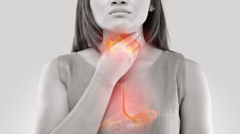 reflusso gastroesofageo e motilex