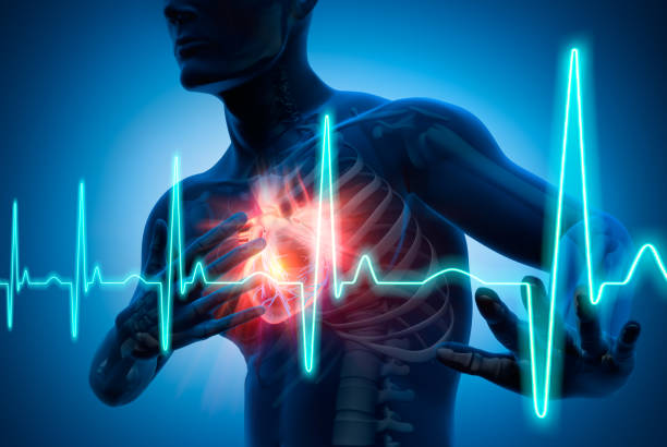 infarto, ictus e salute mentale